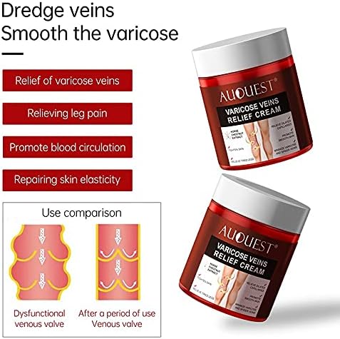 Varicose Veins Relief Cream